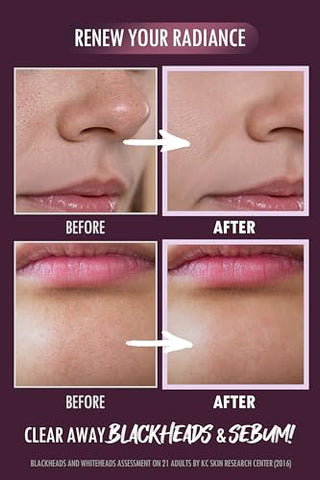 DERMALOGY by NEOGENLAB - NEOGEN PORE TIGHT PEELING MOUSSE 80ml – Mousse Esfoliante para Poros