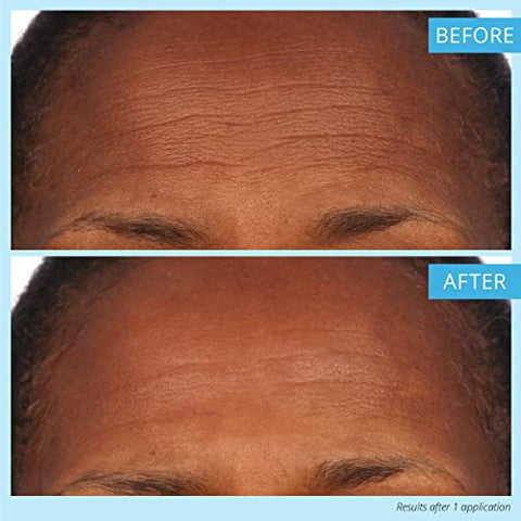 SKINN - Dermappeal Microdermoabrasão Facial Scrub para uma Pele Mais Suave – 50g