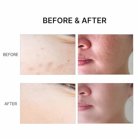 MAY COOP - Essence Moisture Toner para o Rosto – Cuidados com a Pele Coreana [150mL] – Tônico Hidratante com Centella Asiatica Selvagem e Água de Arroz