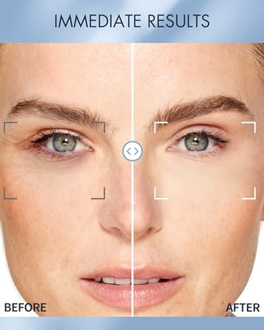 depology - Replenish: Hidratante Facial com Ácido Hialurônico | 30ml  Líder em Cuidados com a Pele