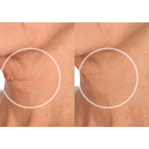 Beauty FaceLift – Adesivos Reutilizáveis Anti-Rugas para Pescoço, Testa, Olhos  SiO Beauty - SiO