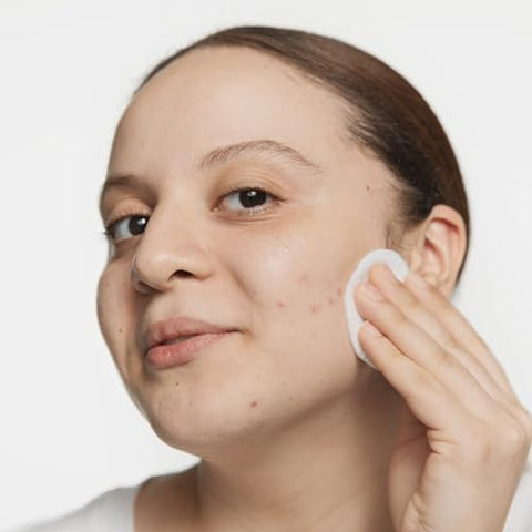 Clinique Loção Facial Tônica Clarificante Acne Solutions – 125ml