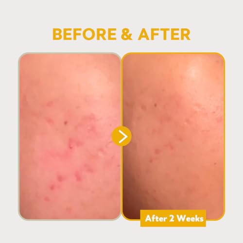 SERUM VITAMINA C PURA 24% 30ml – Potente Antioxidante para a Pele - TIRTIR