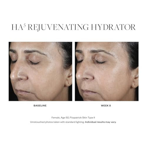 HA5 Rejuvenating Hydrator: Sérum de Ácido Hialurônico para o Rosto com Cinco Tipos de Ácido Hialurônico que Suaviza Linhas Finas e Rugas, Para Todos os Tipos de Pele, 60 ml - SkinMedica