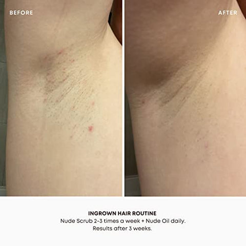 Rotina de 2 Passos Bushbalm para Pelos Encravados e Irritações de Lâmina – Hidratação e Calmante – Óleo Nude para Pelos Encravados (30 ml), Esfoliante Nude (236 ml) – Nude