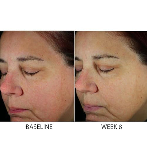 Daily Power Defense – Creme Facial 50ml | Proteção Diária para a Pele - ZO SKIN HEALTH