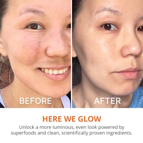 Actives Serum Vitamina C – Clareador com Vitamina C e Ácido Ferúlico, Hidratação Facial e Benefícios Anti-Envelhecimento, Melhora a Descoloração da Pele e Reduz Visivelmente - goPure