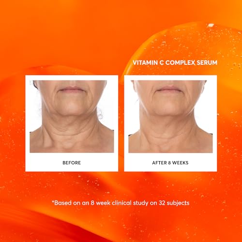 Serum Facial Complexo de Vitamina C, Tratamento Facial Anti-Envelhecimento com Ácido Hialurônico – 30ml - Naturium