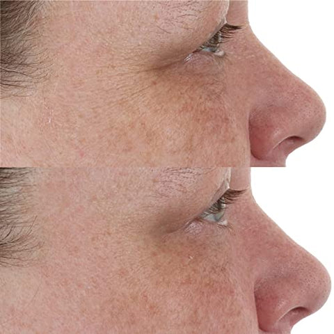 Hidratante Noturno de Recuperação com Retinol de Alta Potência – Classics