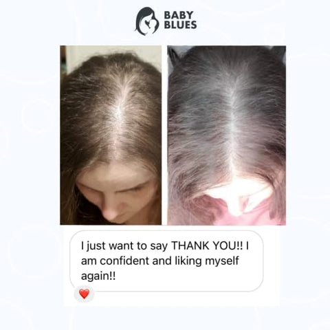 Vitaminas Baby Blues para Queda de Cabelo Pós-Parto – Kit Completo para Ciclo Capilar – com Biotina, Colágeno – Marca Full Hair