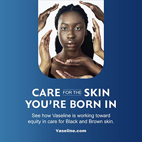 Vaseline - Vaselina Jelly de Petróleo, Recomendada por Dermatologistas, Original, 100% Petrolato Branco, Hidratante Profundo, Alivia a Pele Opaca e Seca, Calmante