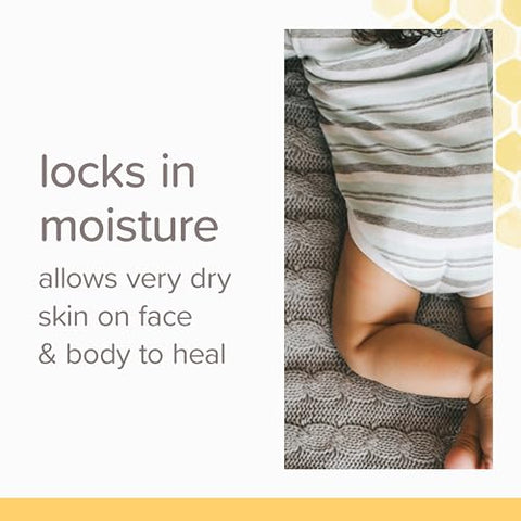 Burt's Bees - Burt’s Bees Baby Pomada Cicatrizante Facial 100% Natural – 30g