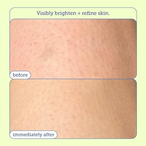 Resurface Scrub Renovador com Ácido Glicólico: Esfoliante Dupla Ação AHA BHA - Skinfix
