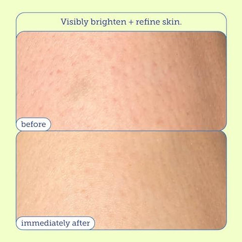Resurface Scrub Renovador com Ácido Glicólico: Esfoliante Dupla Ação AHA BHA - Skinfix