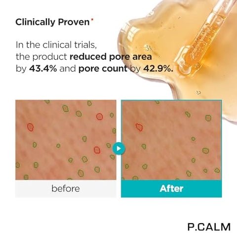 Ampola Retinolagen 30ml | Soro Vegano Sem Fragrância para Pele com Retinol, Colágeno Vegano, Bakuchiol | Cuidados com a Pele Coreanos Cruelty-Free - P.CALM