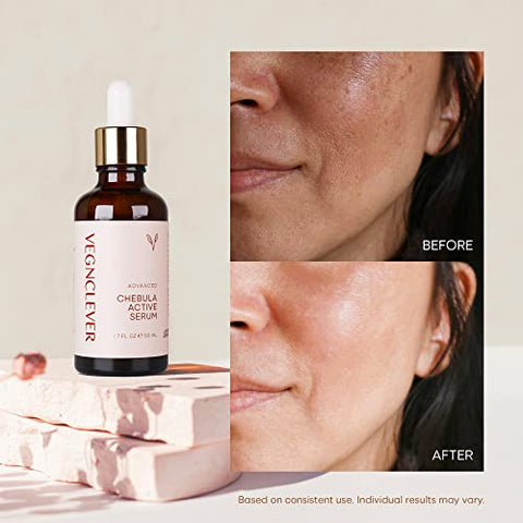Vegnclever - Chebula Active Serum para o Rosto – Serum Antioxidante Anti-Envelhecimento com Ácido Hialurônico e Vitamina C – Hidratante  Chebula