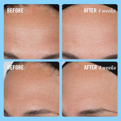 Creme Firmeza First Aid Beauty com Colágeno, Peptídeos e Niacinamida – Hidratante Facial Anti-Envelhecimento Dia e Noite – 50ml