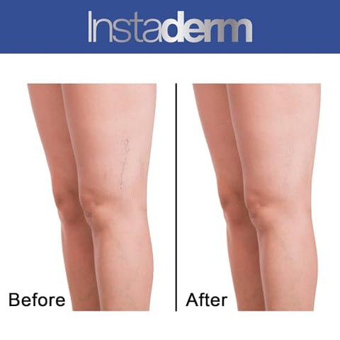 Instaderm - Creme de Vitamina K – Fórmula de Cicatrização de Hematomas com Arnica. Hidratante para Manchas Escuras causadas por Hematomas e Vasinhos