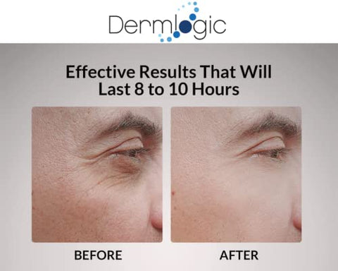 Dermlogic - Redutor de Inchaço Sob os Olhos – Fórmula Avançada – 15ml