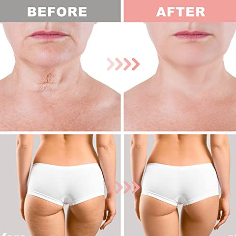 CITYGOO - Creme Firmador de Hibisco e Mel, Loção para Reafirmar a Pele, Reduz a Aparência de Linhas no Pescoço, Tonifica – 100g