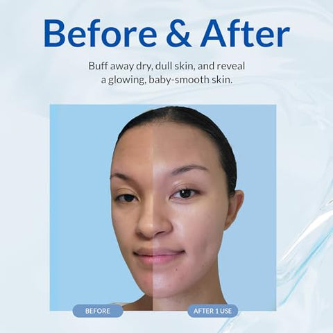 NATURAL AQUA GEL CURE - Cure Aqua Gel – Esfoliante Suave à Base de Água para Rosto e Corpo – Removedor de Pele Morta para uma Pele Jovem, 1 Pacote