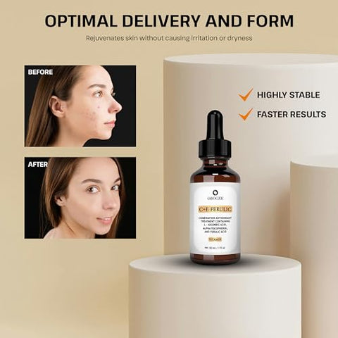 OBOGEE - CE Ferulic Serum – Cuidados com a Pele – Vitamina C e Ácido Ferúlico – Clareador de Manchas – Anti-Envelhecimento – 30ml