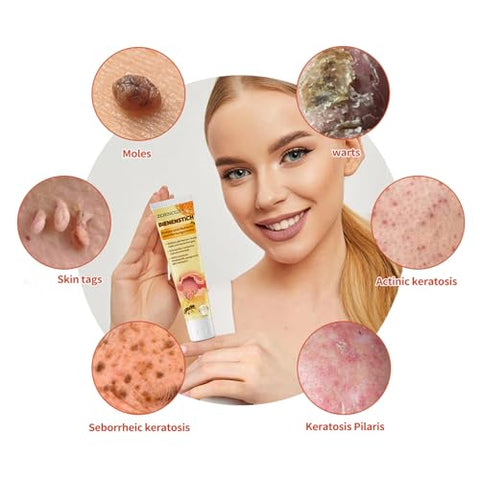 bostore - Gel Profissional de Veneno de Abelha ZOENCGZ – Creme de Própolis para Pescoço, Cintura, Costas, Mãos, Pés e Pernas – Alívio Calmante e Conforto Natural (3PCS)