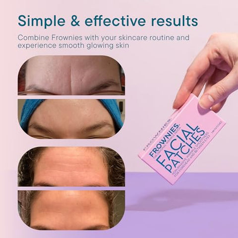 Adesivos Hipoalergênicos para Rugas na Testa e Entre as Sobrancelhas – Suaviza e Alisa a Pele Facial - FROWNIES