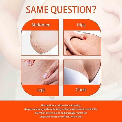 Generic - Bio Oil 200ML – Óleo Essencial para Estrias – Cuidado Profissional