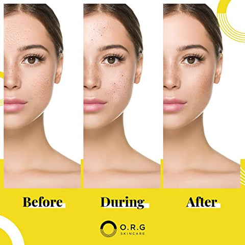 O.R.G. Skincare - ORG Peel Off Face Cleanser para Esfoliação Suave e Pele Radiante – Cuidados Coreanos para Pele Sensível – Redutor de Poros e Agente Clareador – Fórmula Natural Livre de Crueldade 60g