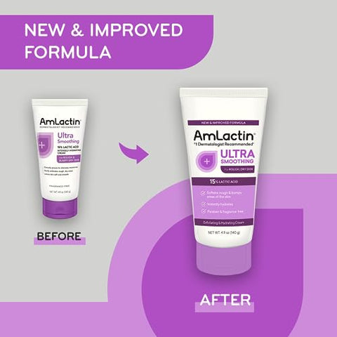 Ultra Smoothing – 4.9 oz (140 g) Corporal: Hidratante para Pele Seca e Áspera - AmLactin