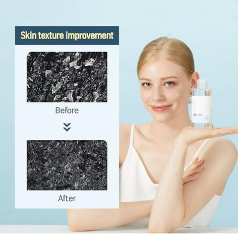 1025 Dokdo Toner e Lotion | Esfoliação suave, Hidratação, Toner Tipo Aquoso, Loção (200ml) - ROUND LAB