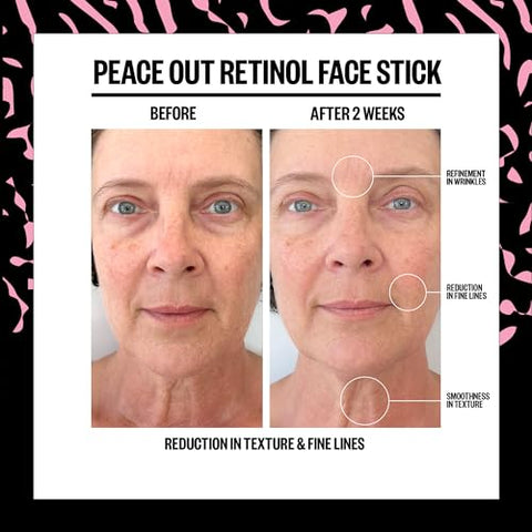 Skincare Retinol Face Stick – Reduza Linhas Finas, Rugas e Textura Irregular com Retinol Encapsulado 3% (8g) - PEACE OUT