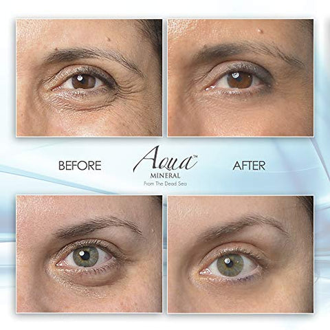 Gel para Olhos Inchados – Resultados Instantâneos – Redução Rápida e Natural – Elimine Rugas, Inchaço e Bolsas – Gel Hidratante para Olhos com Extrato de Chá Verde por Aqua Mineral – 30ml