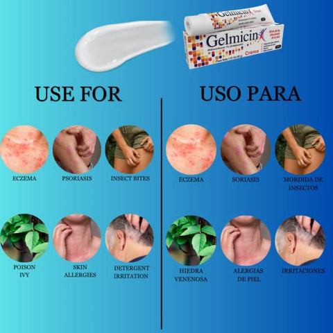Hydrocortisone 1%% – Creme Anti-Coceira, Irritação na Pele, Alergias na Pele, Eczema, Psoríase – Tamanho 40g - Gelmicin