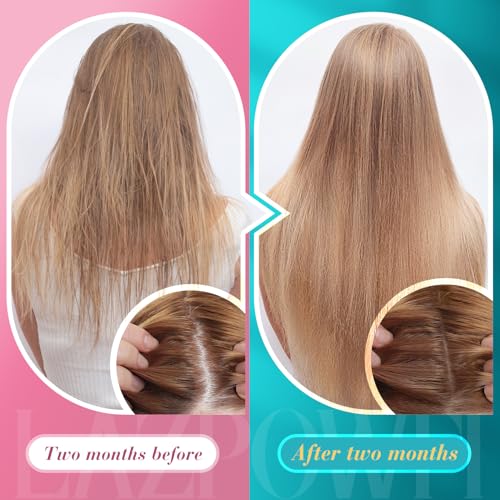 Lazpowfi - Gomas de Biotina para Cabelo, Pele e Unhas – Vitaminas para Cabelo Masculino