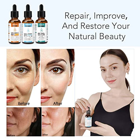 ELBBUB - Sérum Facial Anti-Idade 3 em 1: Vitamina C, Retinol e Ácido Hialurônico – 3 Frascos de 30ml cada (90ml no total)