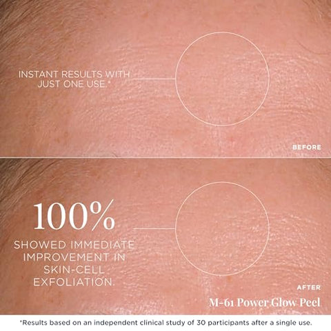 M 61 - M-61 PowerGlow® Peel – 10 Tratamentos – Peel de brilho esfoliante de 1 minuto e 1 passo com glicólico, vitamina K