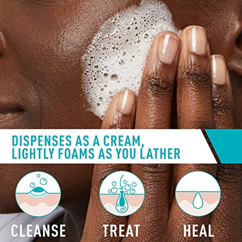 Creme Espumante de Limpeza para Acne | Tratamento para Rosto com 4% de Peróxido de Benzoíla, Ácido Hialurônico e Niacinamida | Fórmula Creme para Espuma | Sem Fragrância - CeraVe