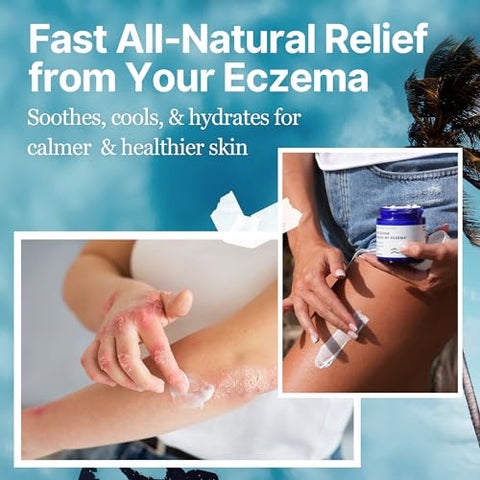 The Ocean Healed My Eczema - Creme Calmante Natural – Algas Marinhas Aveia Coloidal – para Pele Propensa a Eczema Psoríase – Minerais do Mar – para Pele Sensível – Creme Hidratante para Eczema em Pele Seca (120g)
