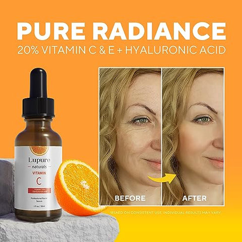 Lupure - Sérum Facial Profissional de Vitamina C 20%, Super Vit C Anti-Envelhecimento com Ácido Hialurônico