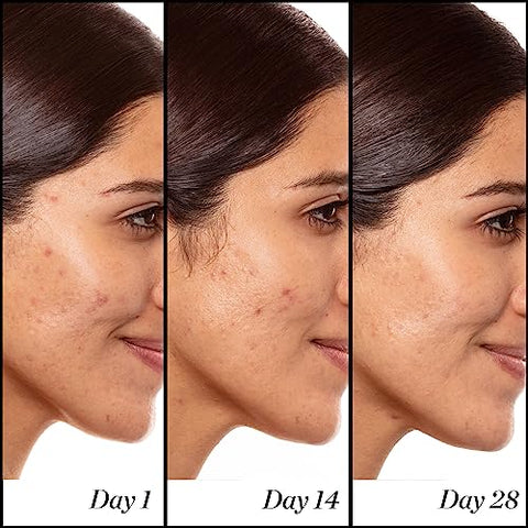 Sunday Riley Serum Retinol Anti-Envelhecimento de Alta Potência – 30ml