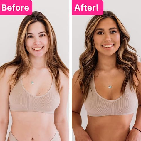Autobronzeador – Loção Autobronzeadora para o Corpo, Correção de Cor com Aspecto Natural - Tanceuticals