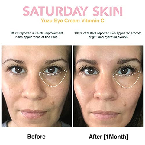 Creme para os Olhos Yuzu Vitamina C Iluminador Amplo Creme Coreano para Olheiras, Rugas e Olhos Inchados – Niacinamida, Cafeína – Hidratação, Anti-Envelhecimento [Brand Name] - Saturday Skin