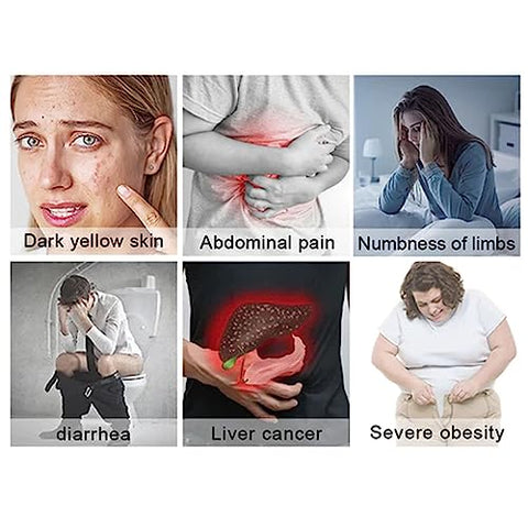 Cardo Mariano – Desintoxicação e Proteção Hepática – 60 Cápsulas - LOEBKE