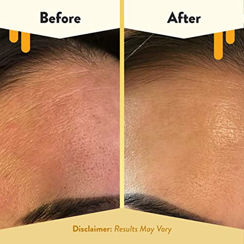Soro Facial Nutritivo ECZEMA HONEY – Hidratante Diário – Óleo Facial para Eczema, Pele Seca – 30ml