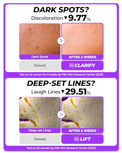 Dermafirm - [DERMAFIRM] Sérum Reparador Calmante R4 | Sérum Facial de Bakuchiol com Niacinamida | 30ml