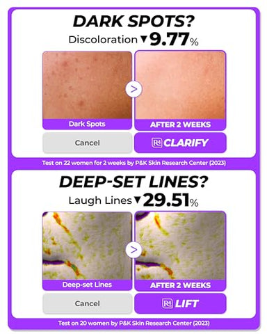 Dermafirm - [DERMAFIRM] Sérum Reparador Calmante R4 | Sérum Facial de Bakuchiol com Niacinamida | 30ml
