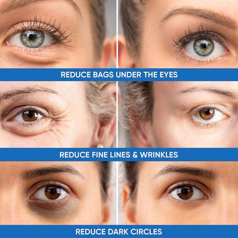 Dermlogic - Redutor de Inchaço Sob os Olhos – Fórmula Avançada – 15ml