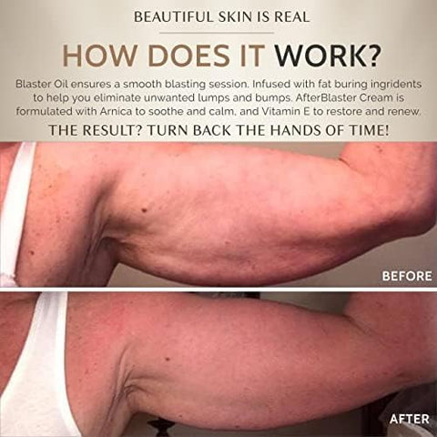 FasciaBlaster - Óleo Blaster por Ashley Black – Use com FasciaBlasting para Resultados Máximos – Óleo Queima Gordura Blaster e Arnica Calmante e Firmadores de Pele para Pós FasciaBlasting (Óleo)